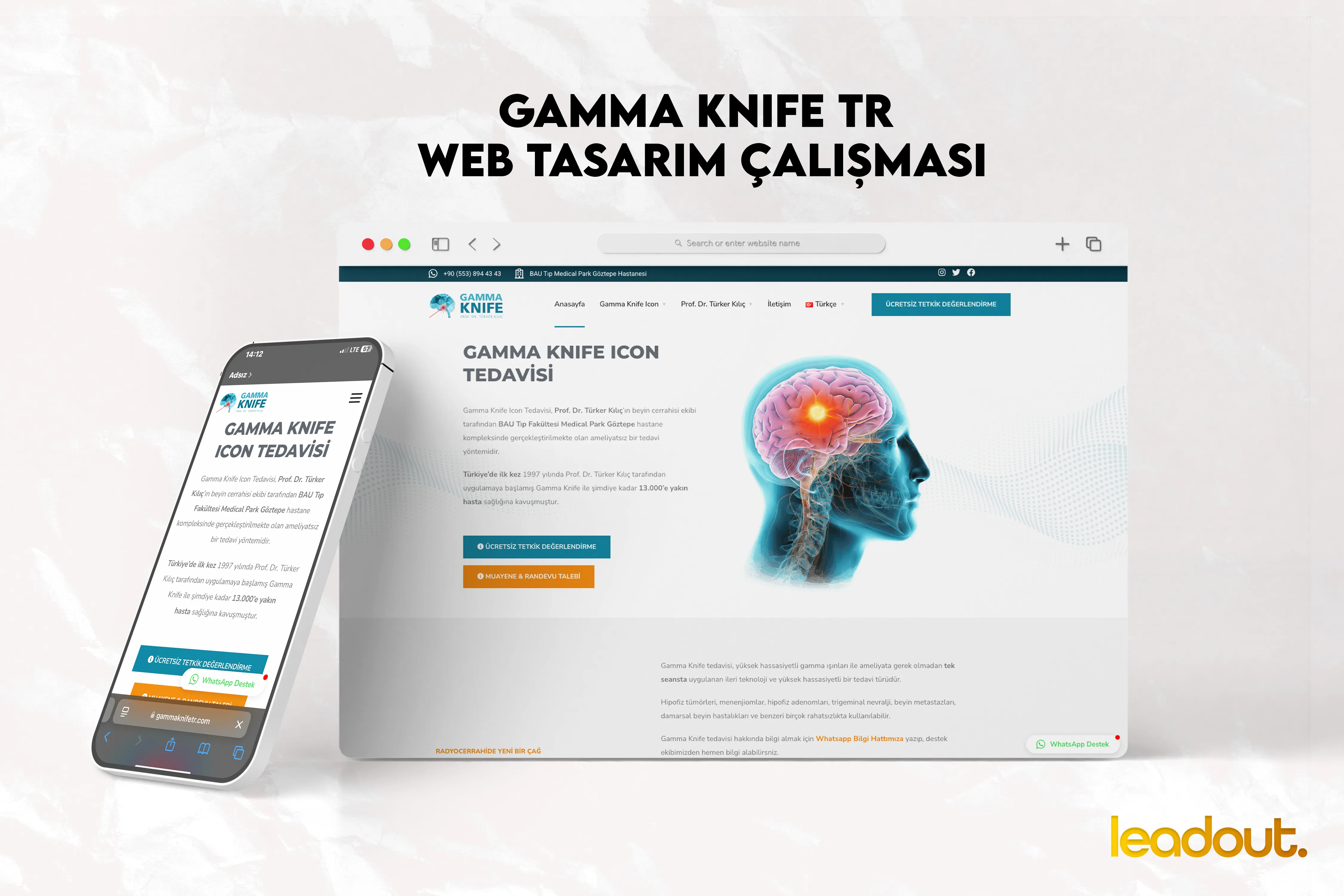 Gamma Knife